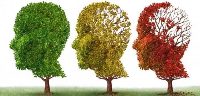 Os 3 estágios do mal de Alzheimer